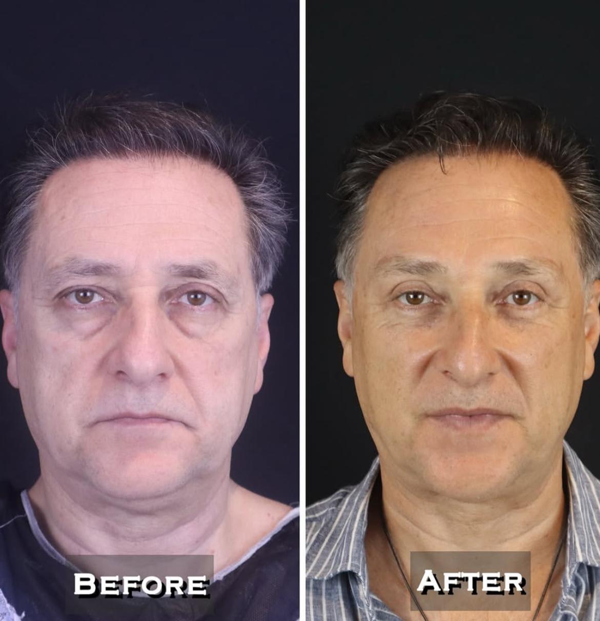 Eyelid Surgery · Plastic Surgery