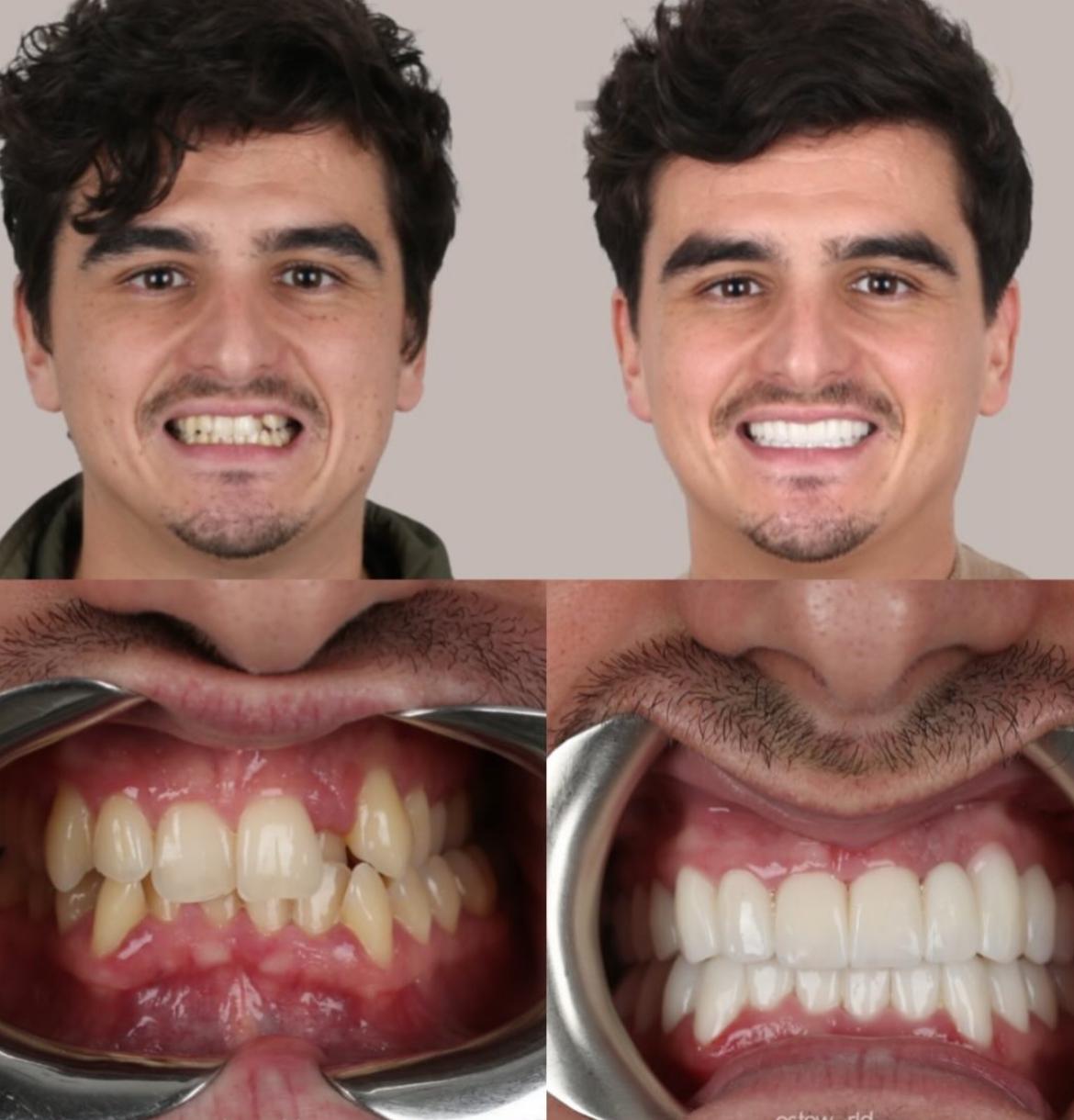 Hollywood Smile · Dental Treatments
