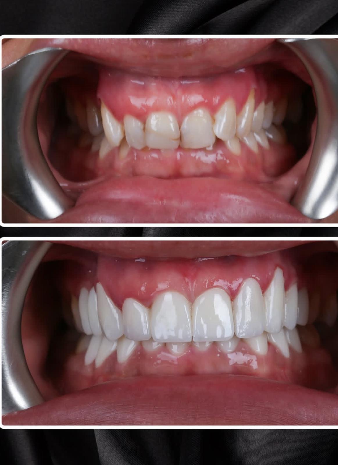 Hollywood Smile · Dental Treatments
