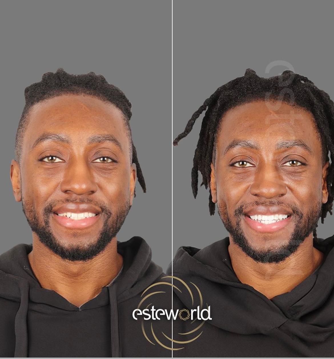 Hollywood Smile · Dental Treatments